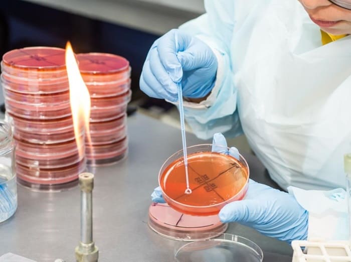 Microbiología listeria